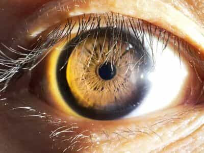 1024px human eye in bright light