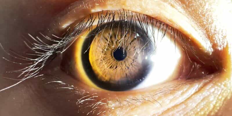 1024px human eye in bright light