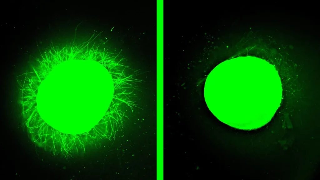 Να μ’ αγαπάς: Ο Λευτέρης βρίσκει γαζωμένο από σφαίρες το αμάξι του Άγγελου