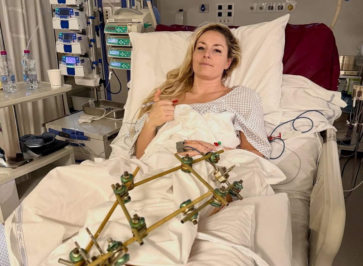 Πόσο καιρό παραμένουν τα στεροειδή στον οργανισμό;