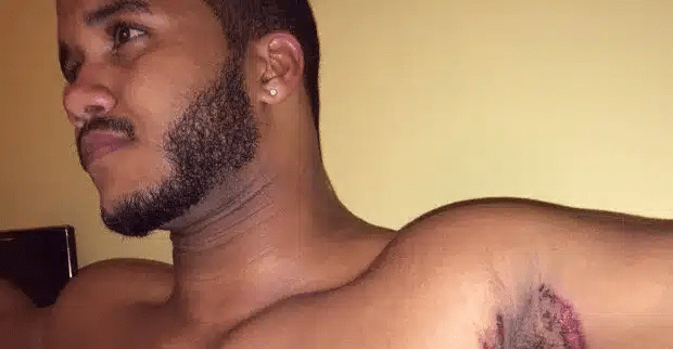 Απίστευτο περιστατικό στο Νοσοκομείο Παίδων: Τρίχρονος κατάπιε ξυράφι – Υποβλήθηκε σε χειρουργείο (Βίντεο)