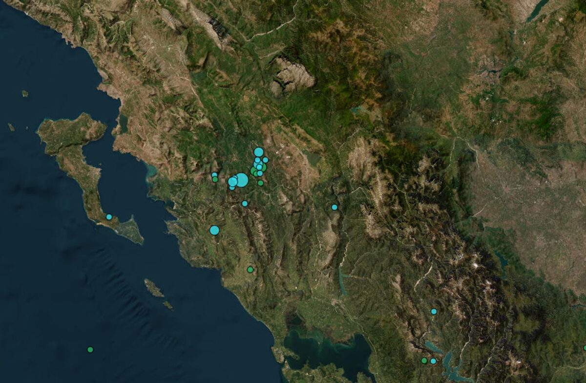 Ο «σιωπηλός κλέφτης» της όρασης: Όσα πρέπει να γνωρίζουμε για το γλαύκωμα