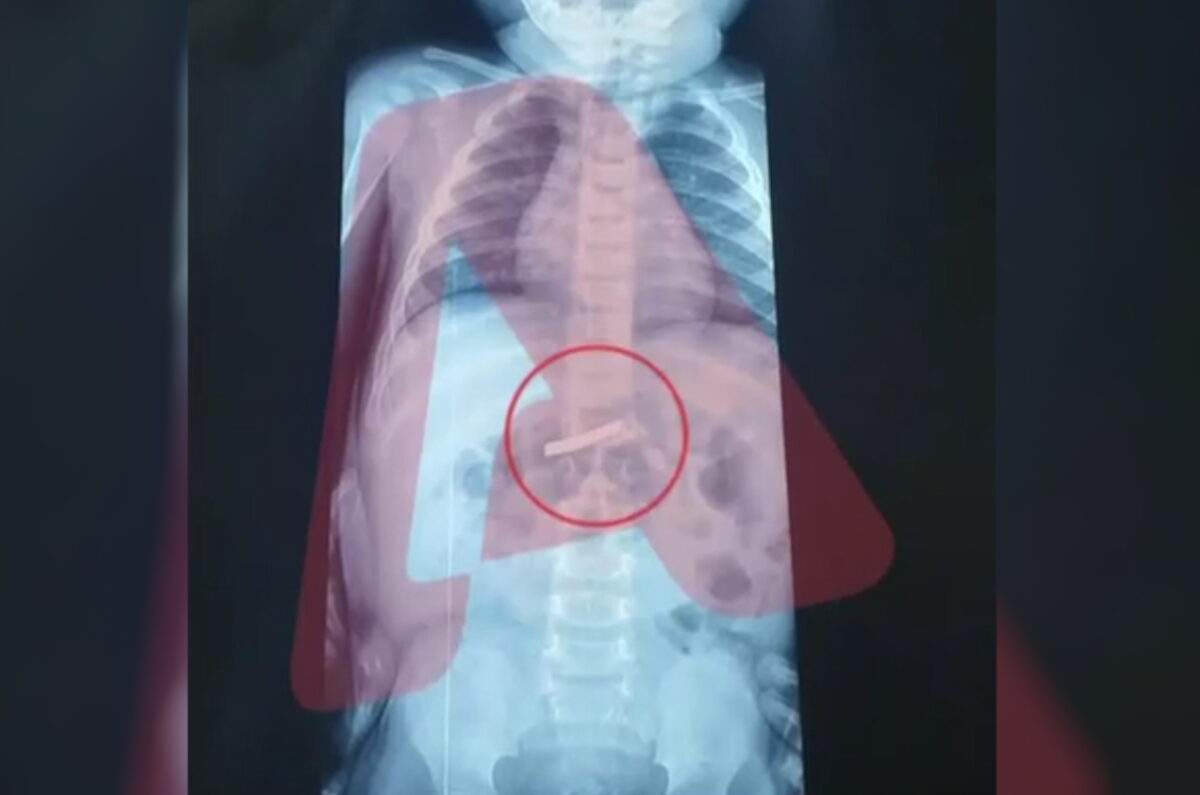 Η «τάφρος» των απορριμμάτων: Η ρύπανση έφτασε στο βαθύτερο σημείο της Μεσογείου, στην Πύλο